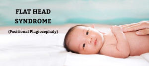photo of baby and text Flat Head Syndrome (Positional Plagiocephaly)
