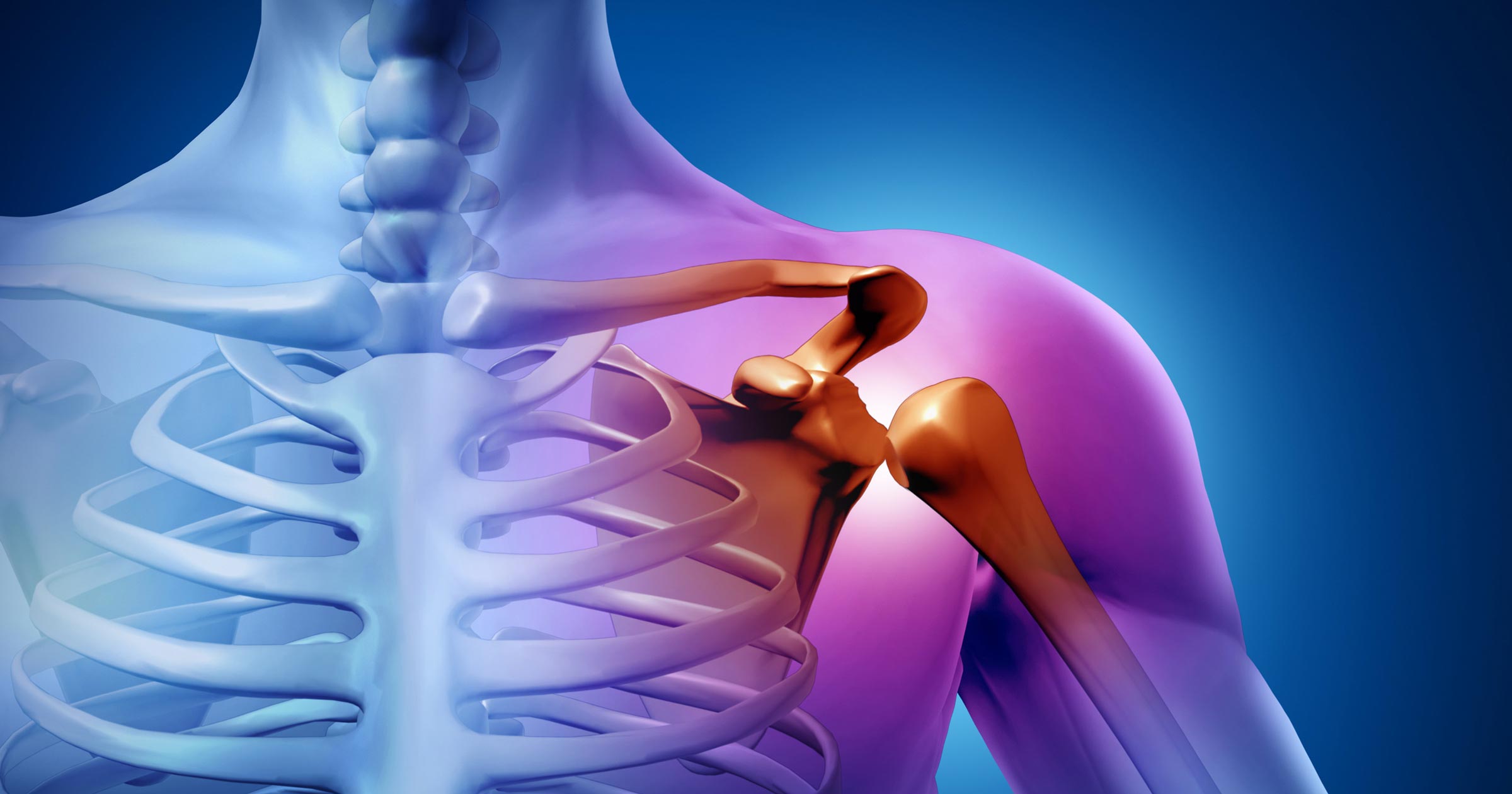 Shoulder impingement East Gippsland Osteopathic Clinic