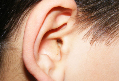 Can osteopathy help glue ear?